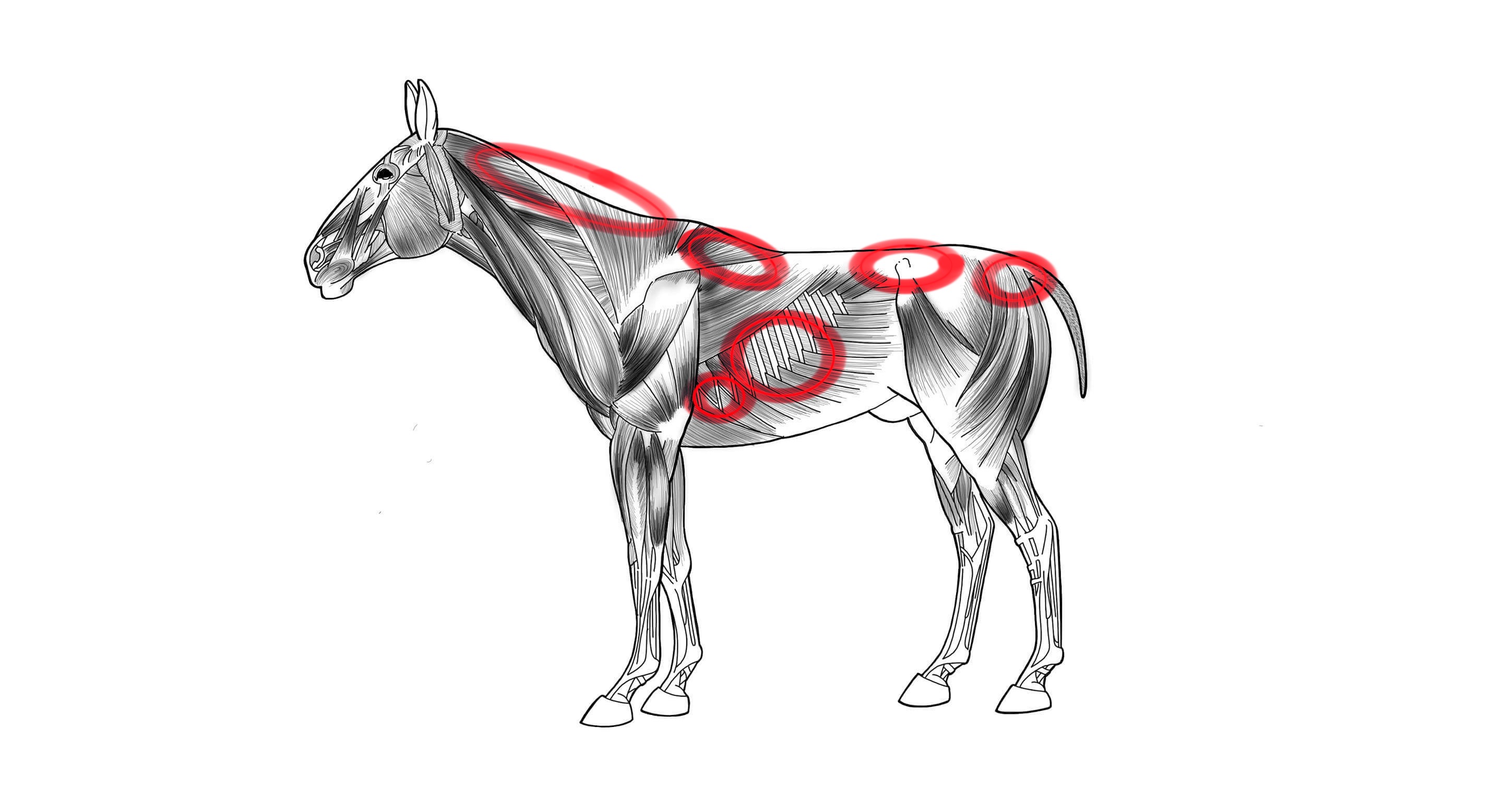Henneken lihavuuskuntoluokitus